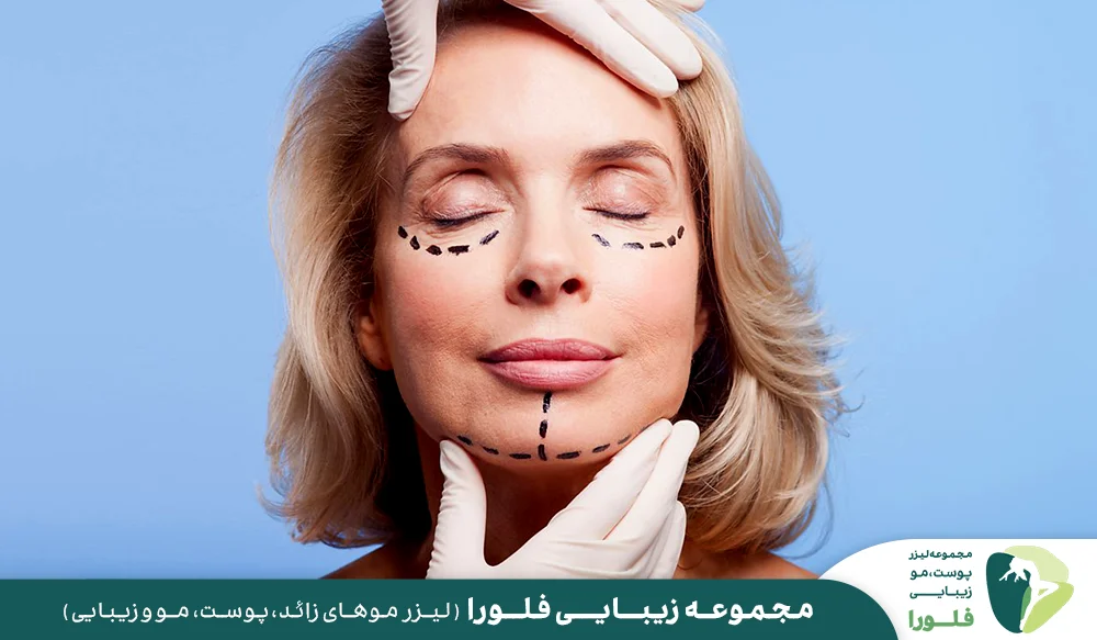 زاویه سازی فک با جراحی