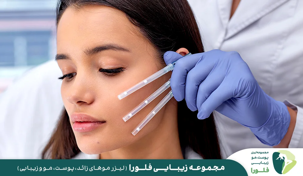افراد مناسب برای لیفت صورت با نخ