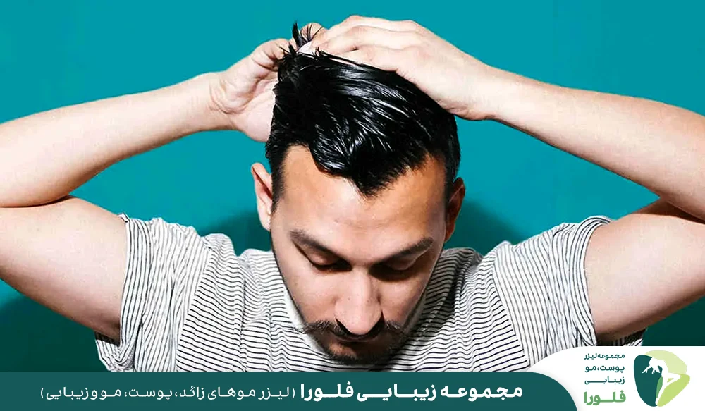 استفاده از ویتامین ها و مواد مغذی برای تقویت موی سر