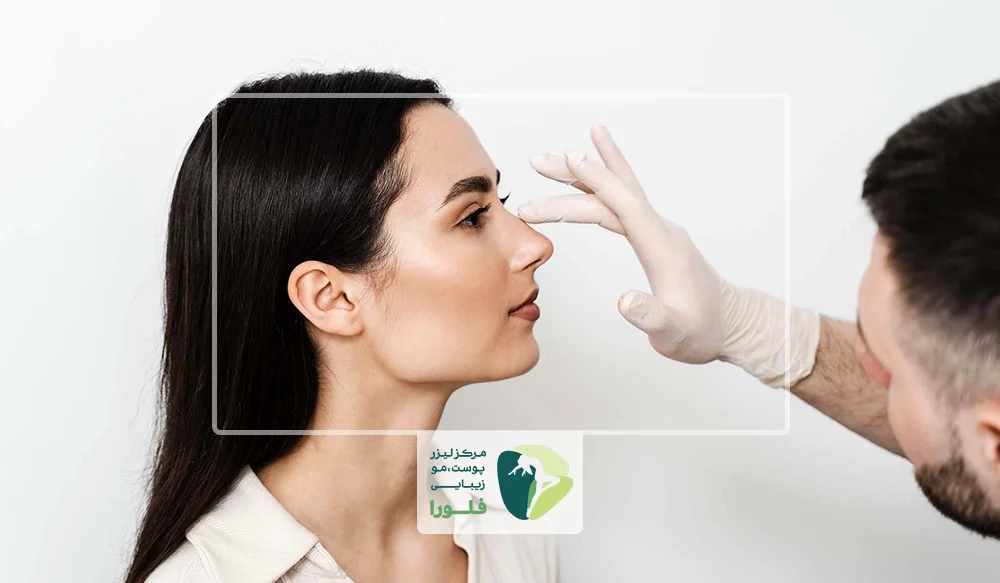 اصلاح فرم بینی با تزریق فیلر