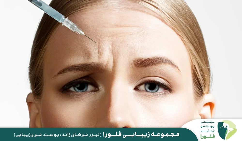 مزایای تزریق ژل و فیلر برای رفع خطوط ابرو