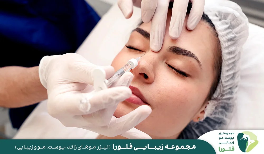 انواع ماده پرکننده برای اصلاح فرم بینی
