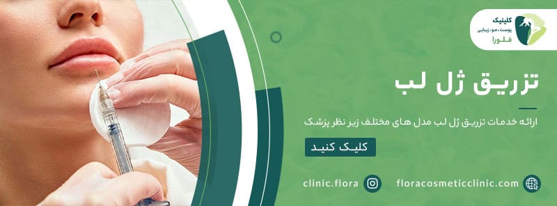تزریق ژل لب