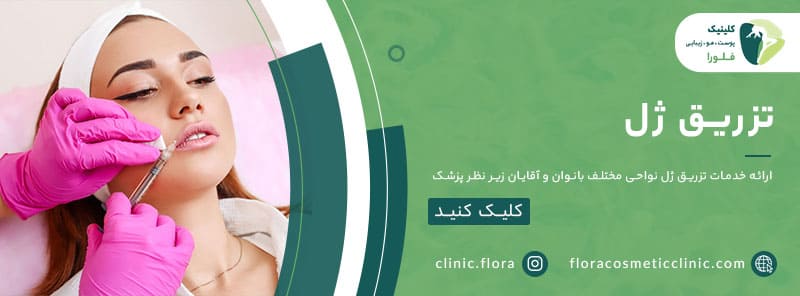 تزریق ژل