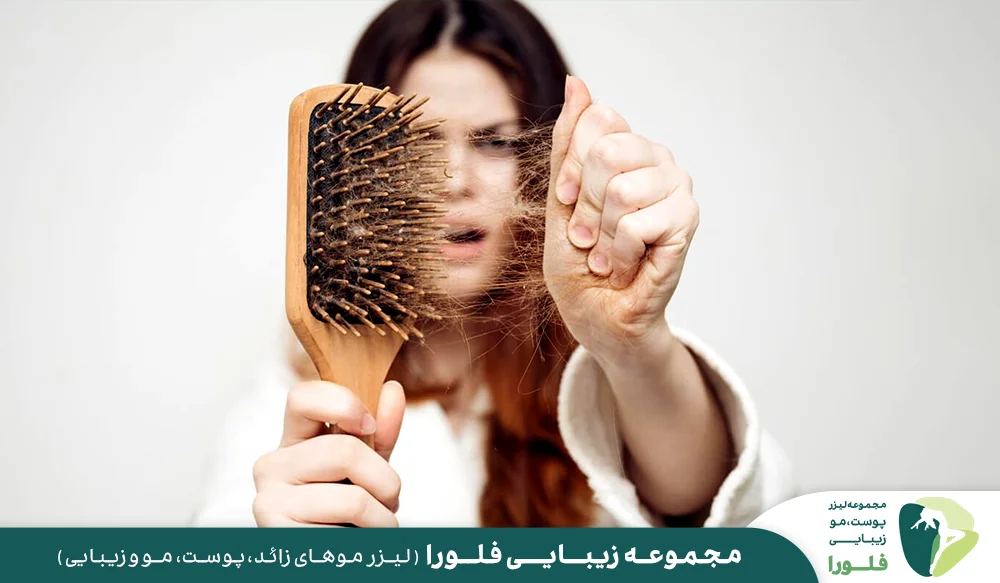 تشخیص درست علت ریزش موی سر
