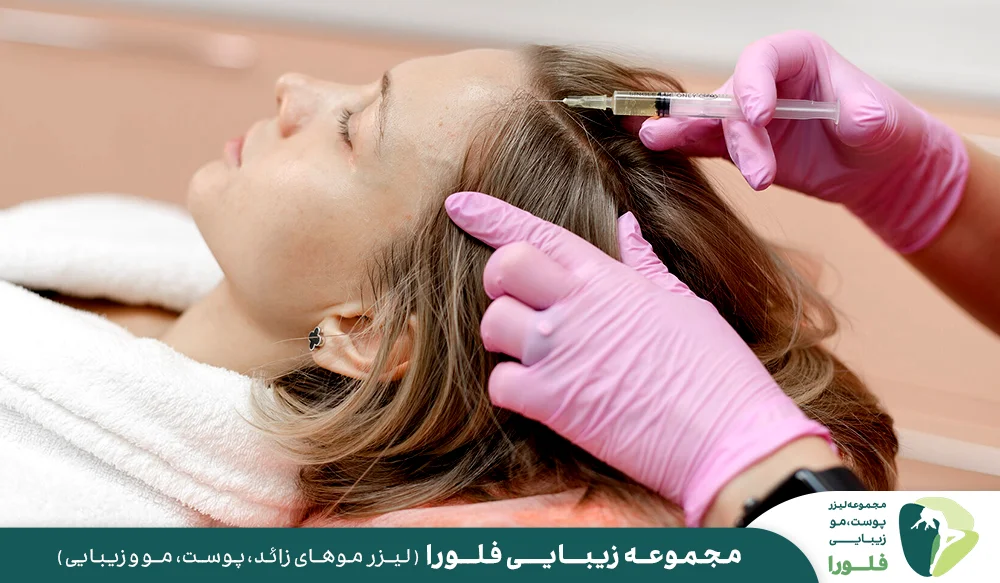 تقویت مو و جلوگیری از ریزش موی سر با مزوتراپی (بهترین روش)
