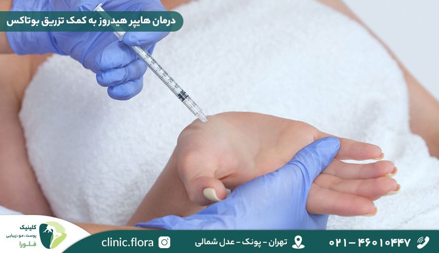 درمان هایپر هیدروز به کمک تزریق بوتاکس