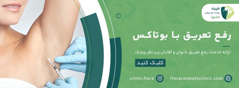 رفع تعریق با بوتاکس