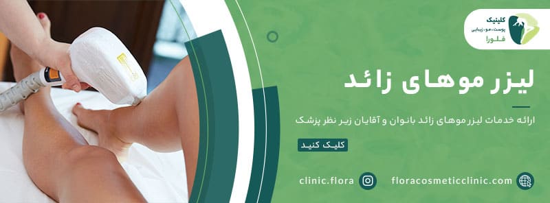 لیزر مو