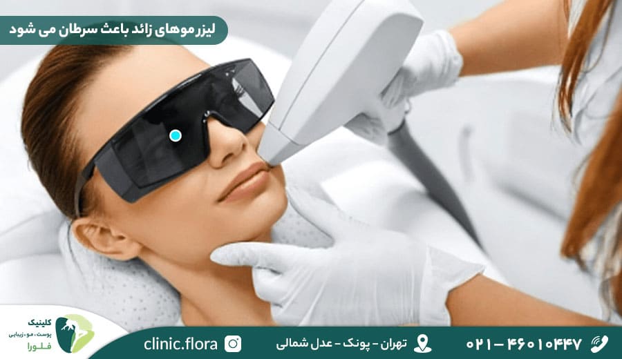 لیزر موهای زائد باعث سرطان می شود