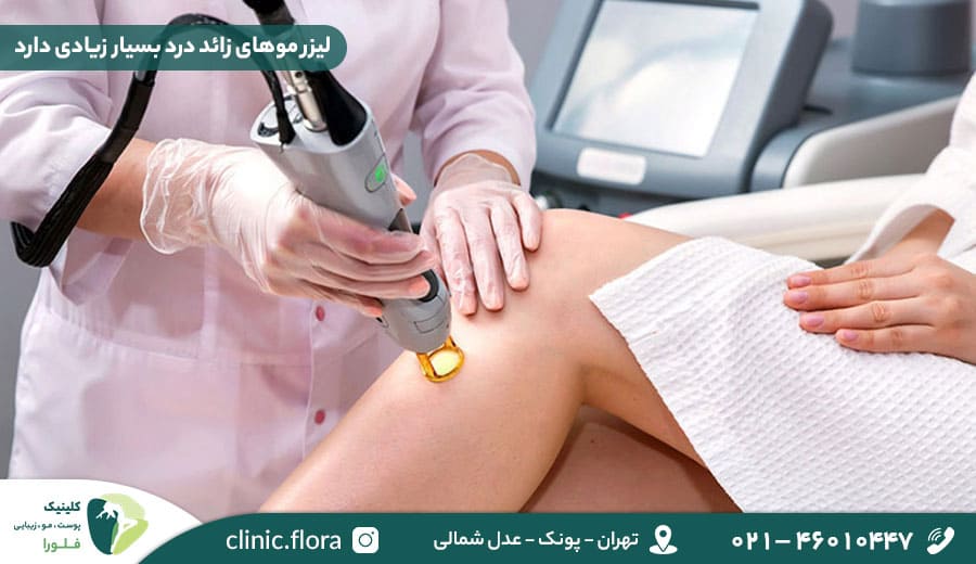 لیزر موهای زائد درد بسیار زیادی دارد