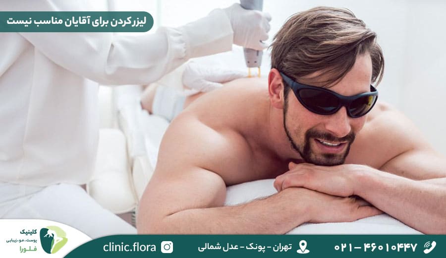 لیزر کردن برای آقایان مناسب نیست