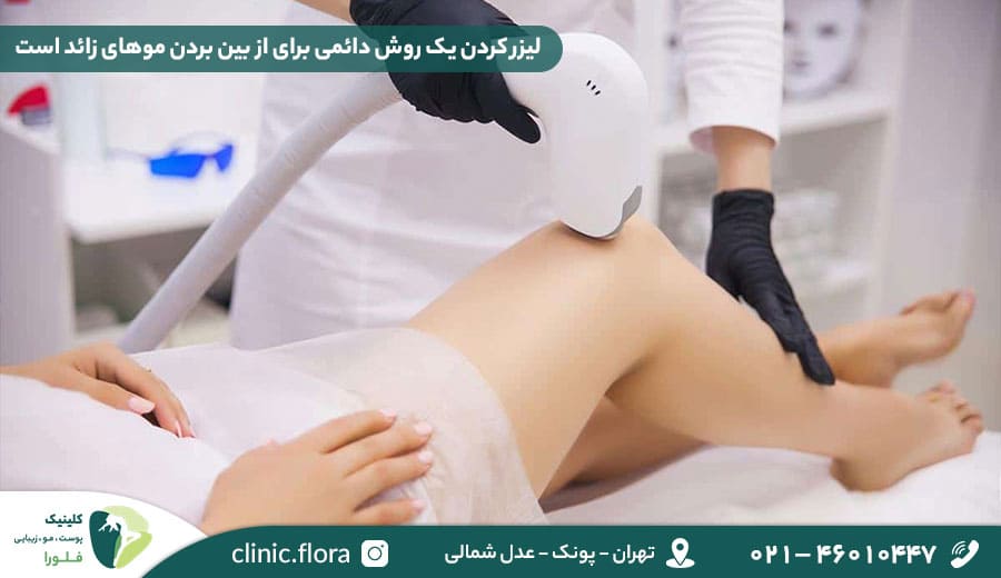 لیزر کردن یک روش دائمی برای از بین بردن موهای زائد است