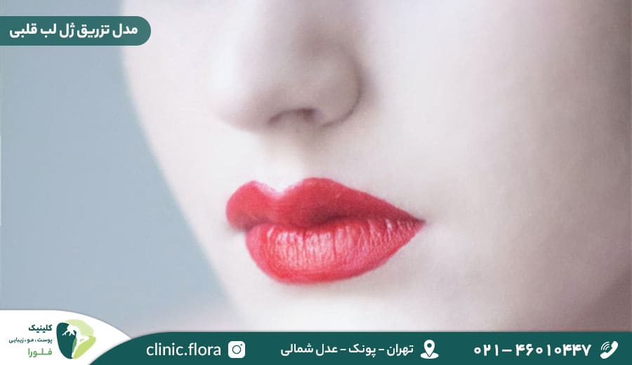 مدل تزریق ژل لب قلبی