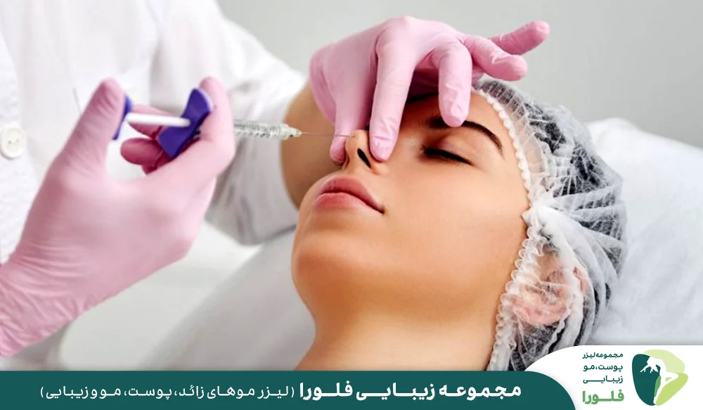 مراحل اصلاح فرم بینی با تزریق فیلر