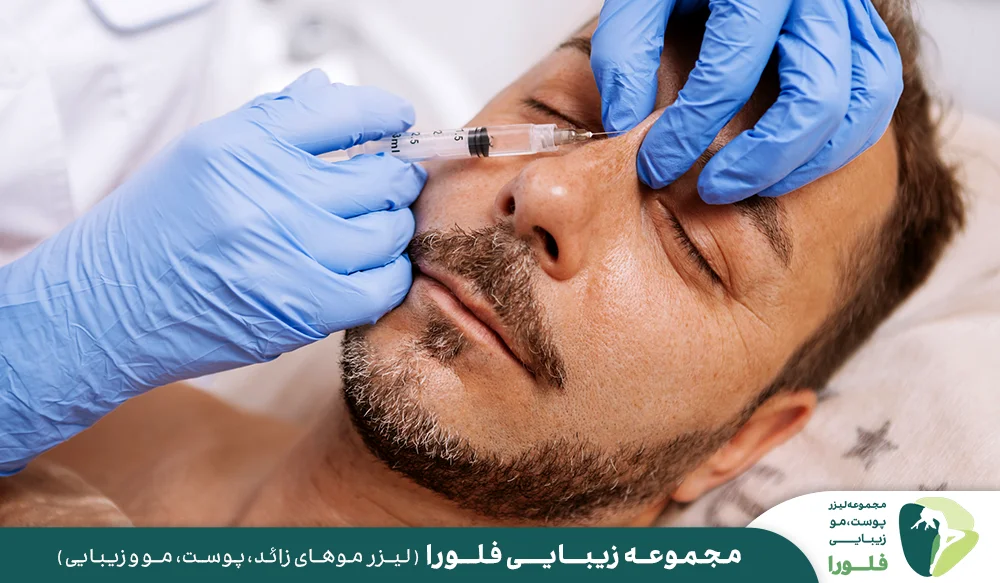 مزایای تزریق فیلر بینی