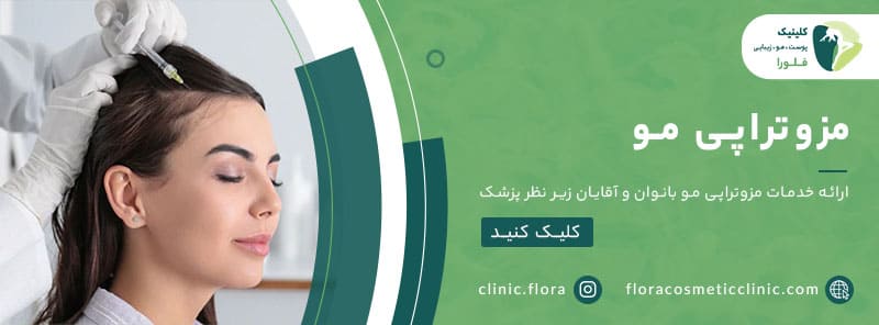مزوتراپی مو