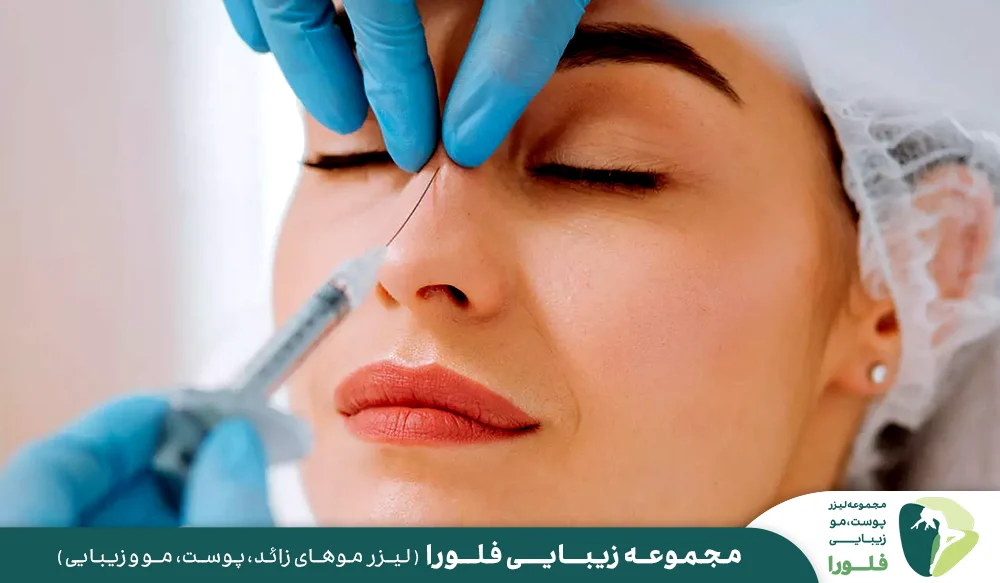چه افرادی می توانند فیلر بینی انجام دهند؟