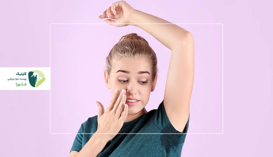 بهترین روش جلوگیری از عرق کردن زیاد