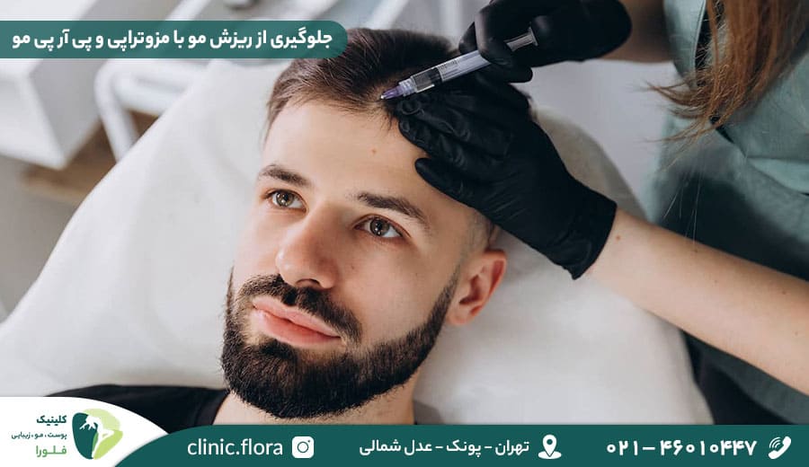 جلوگیری از ریزش مو با مزوتراپی و PRP مو