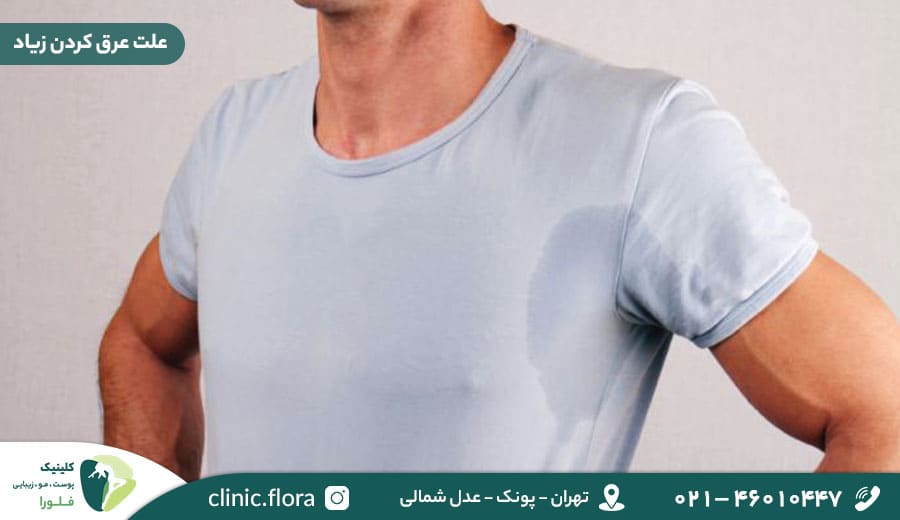 علت عرق کردن زیاد