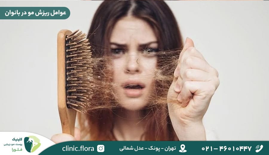 عوامل ریزش مو در بانوان