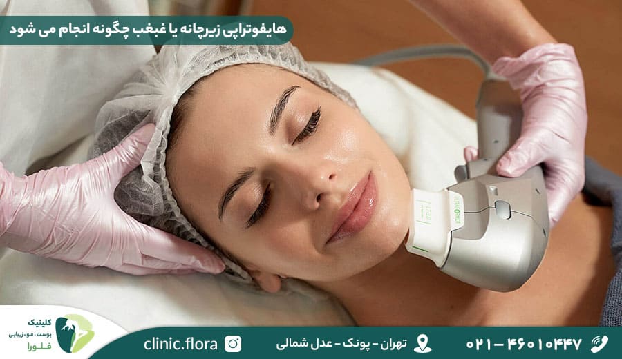 هایفوتراپی زیرچانه یا غبغب چگونه انجام می شود