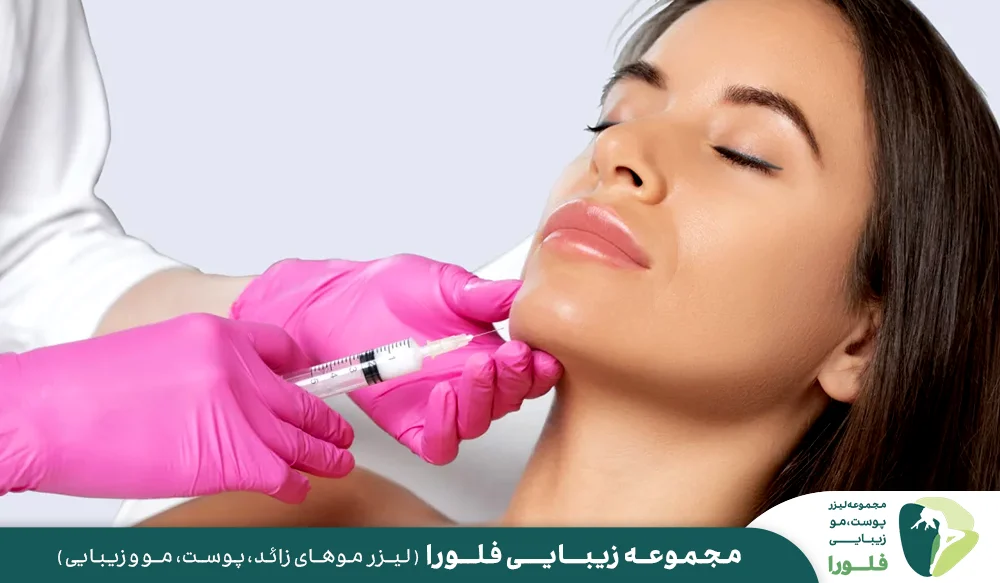 اصلاح فرم چانه