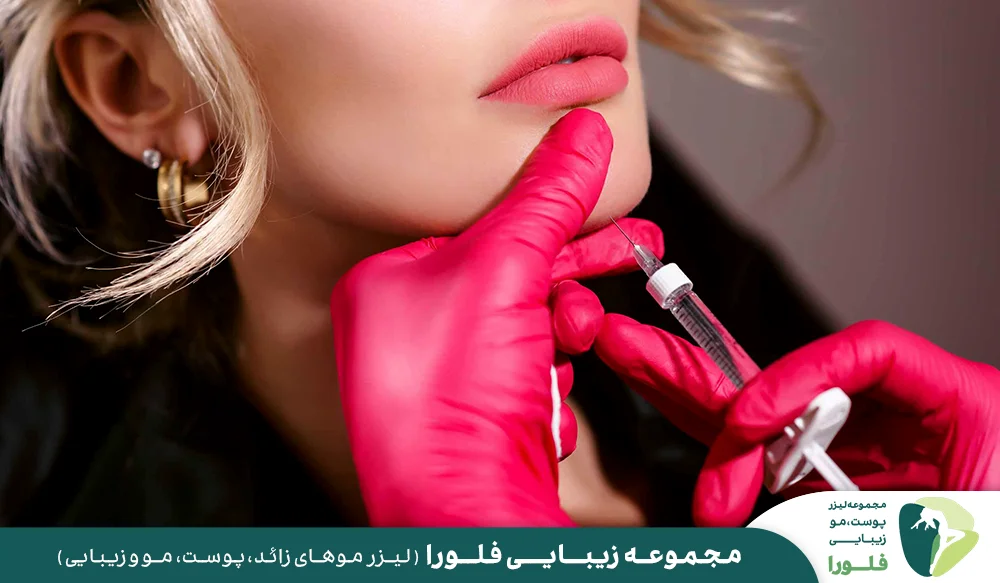 مزایای تزریق ژل چانه و اصلاح فرم چانه