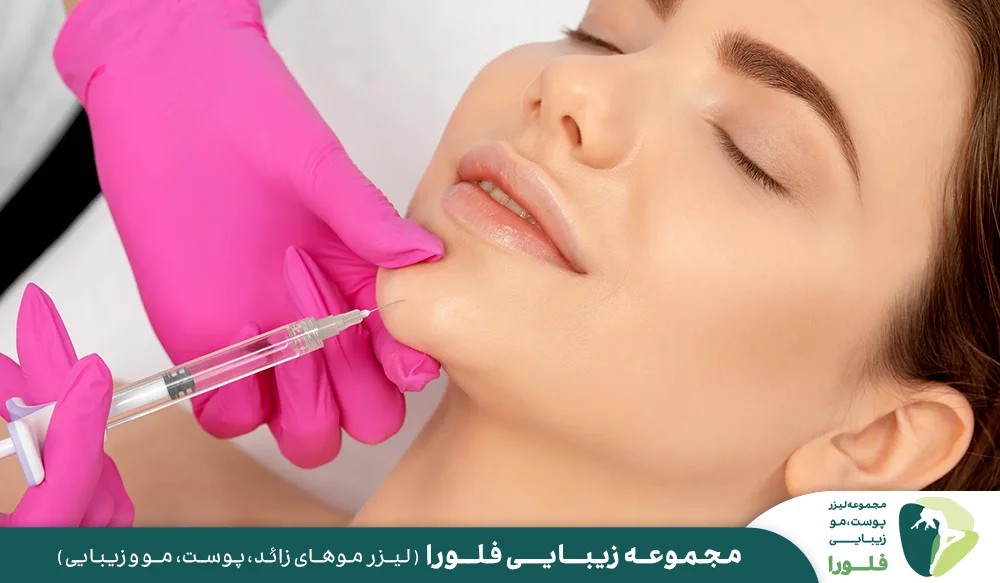 میزان ماندگاری تزریق ژل چانه چقدر است؟