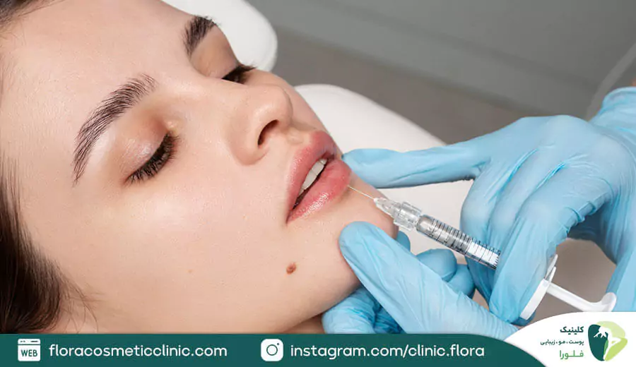 چه کسانی می توانند مدل لب عروسکی تزریق کنند؟