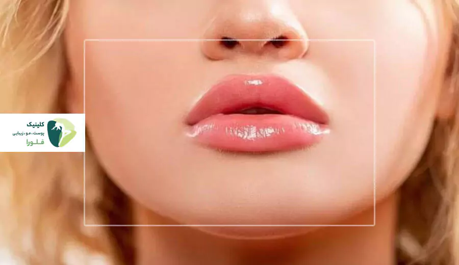 همه چیز درباره مدل لب عروسکی
