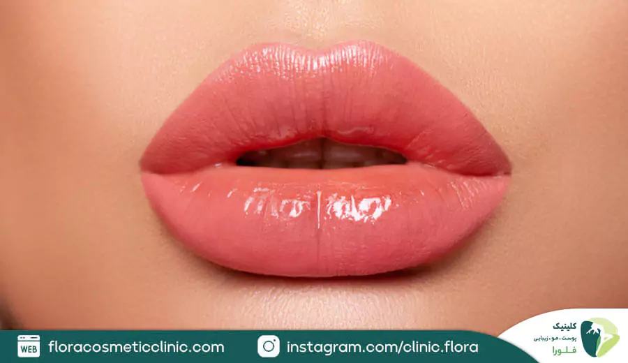 مدل لب عروسکی چه شکلی است؟