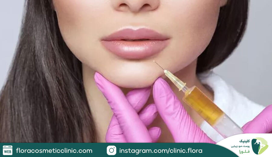 چه کسانی می توانند مدل لب روسی تزریق کنند؟
