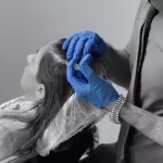 مزوتراپی مو
