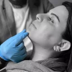 اصلاح فرم چانه