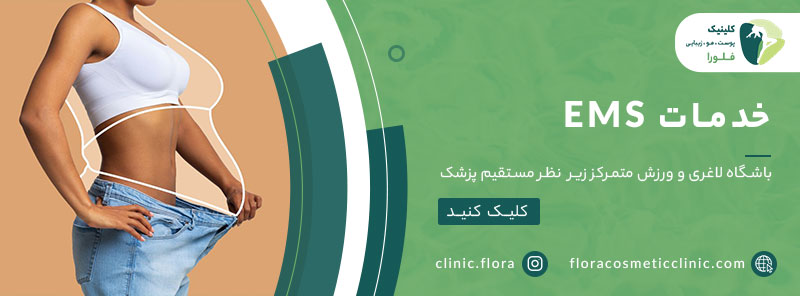 باشگاه ems