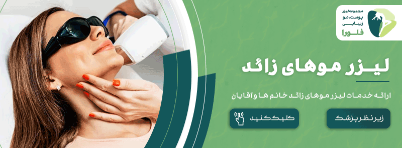 لیزر موهای زائد تهران