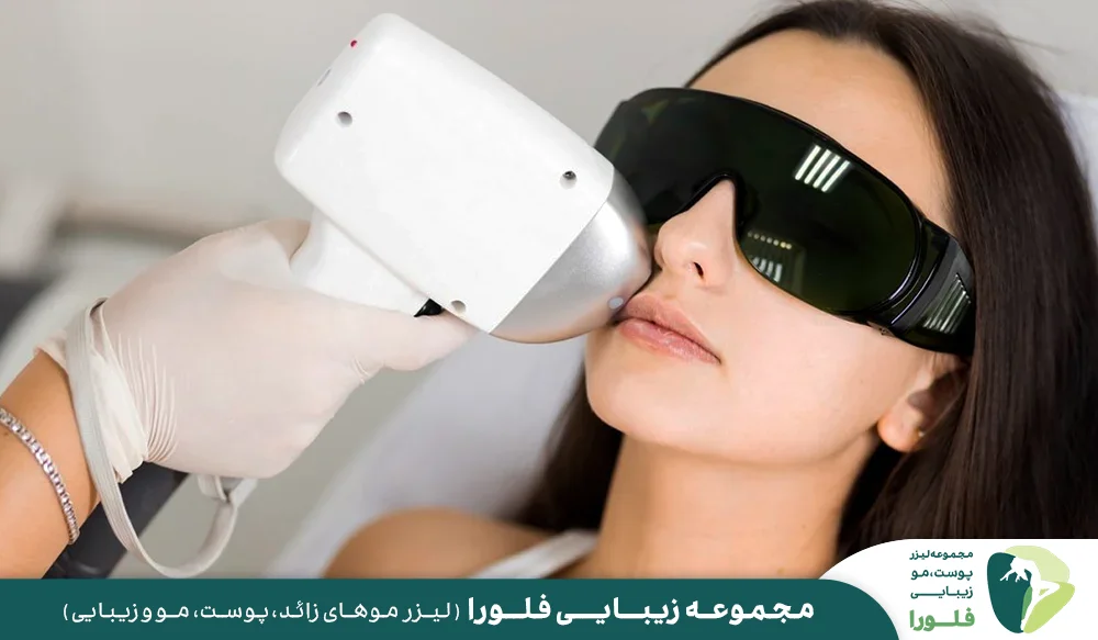 آیا لیزر صورت به طور کامل موهای زائد را از بین می برد؟