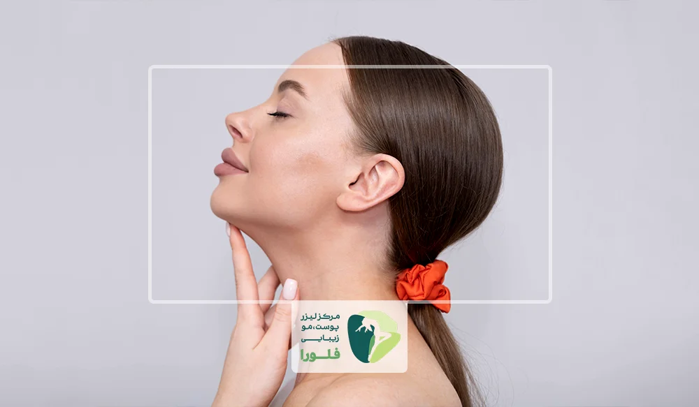 اصلاح فرم چانه با تزریق ژل