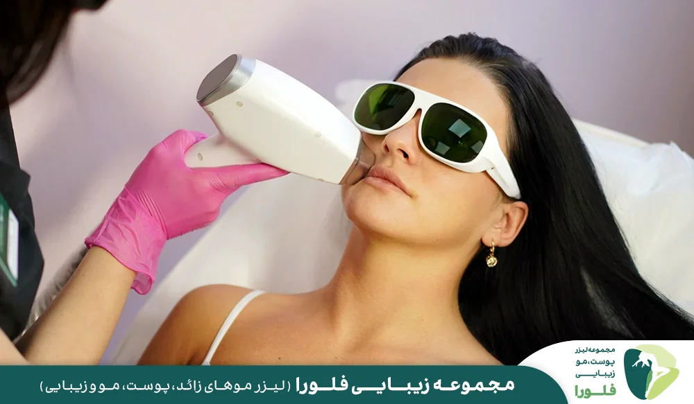 لیزر موهای زائد صورت