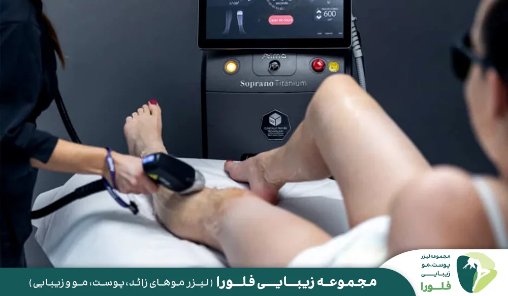 لیزر موهای زائد پا در مجموعه زیبایی فلورا