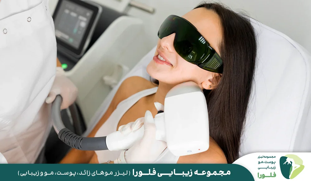 نکات مهم در خصوص لیزر صورت