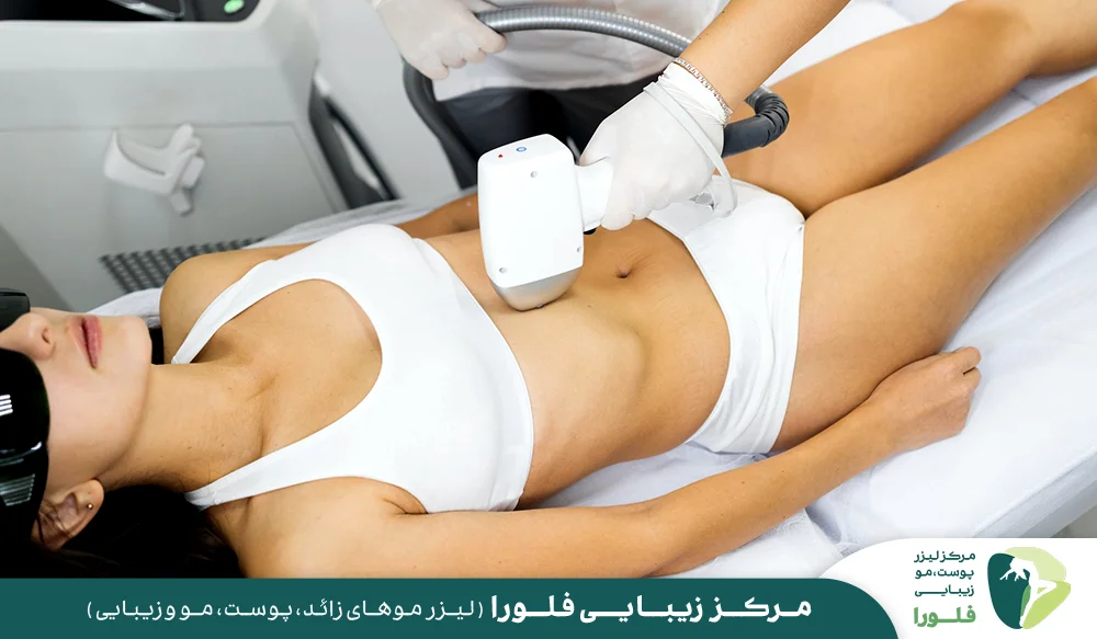 آیا لیزر موهای زائد باعث نازایی میشود؟