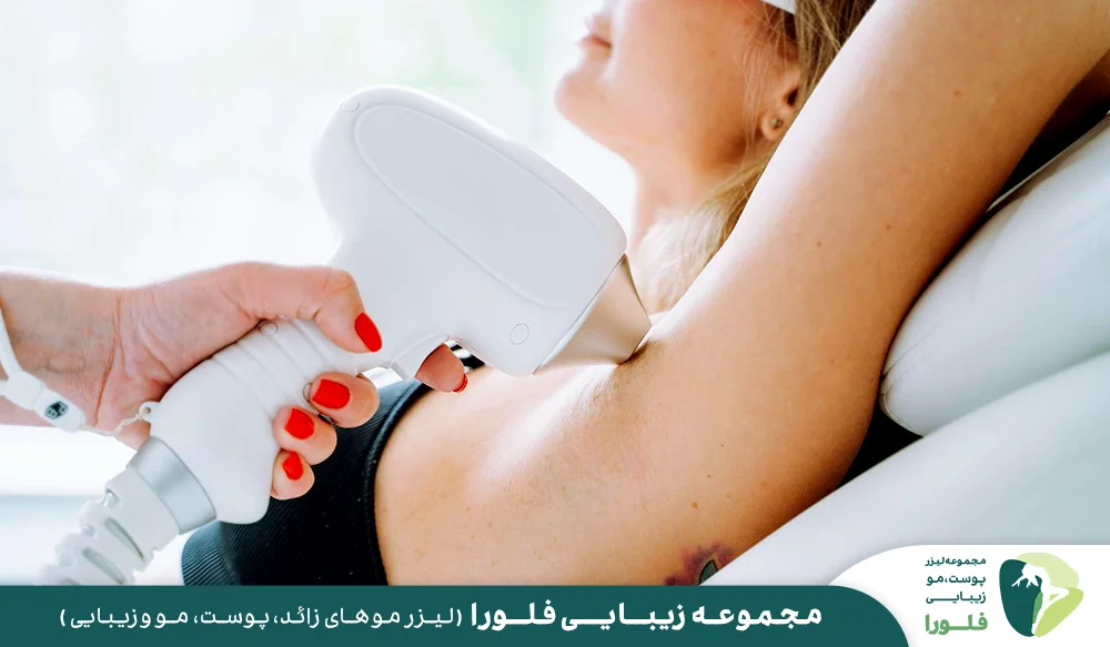 محدودیت ها و موارد منع استفاده از لیزر مو