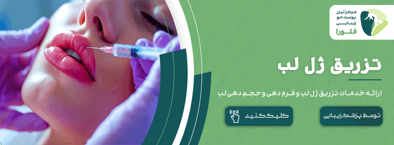 تزریق ژل لب