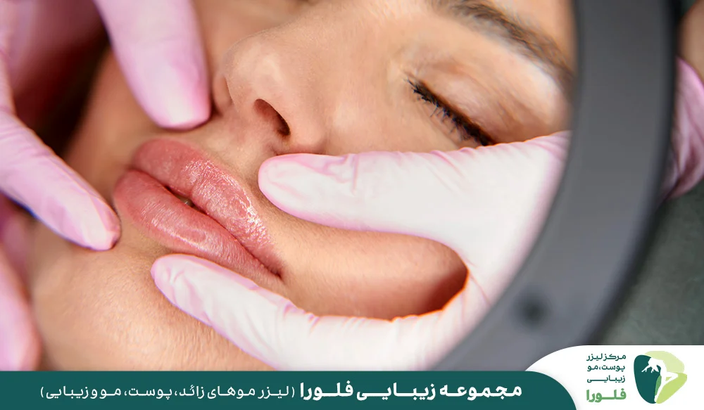 مراقبت های قبل و بعد از تزریق لب