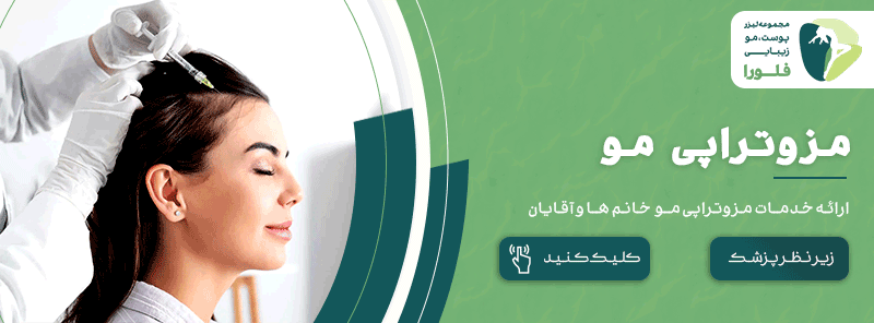 مزوتراپی مو