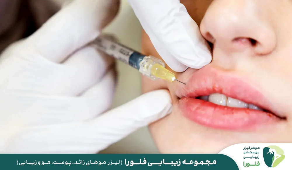 ویژگی های یک کلینیک معتبر برای تزریق لب