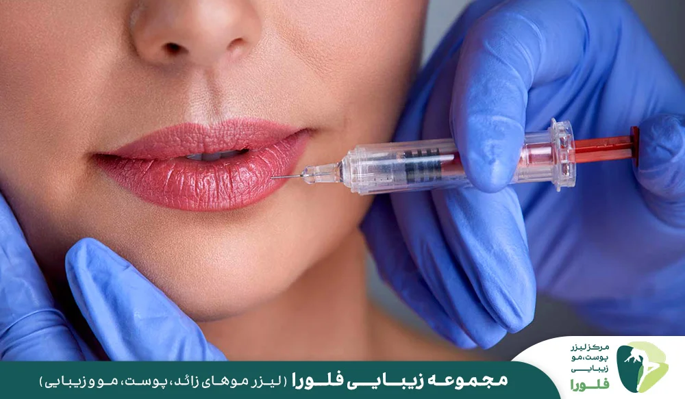 چرا کلینیک فلورا بهترین انتخاب برای تزریق لب در تهران است؟